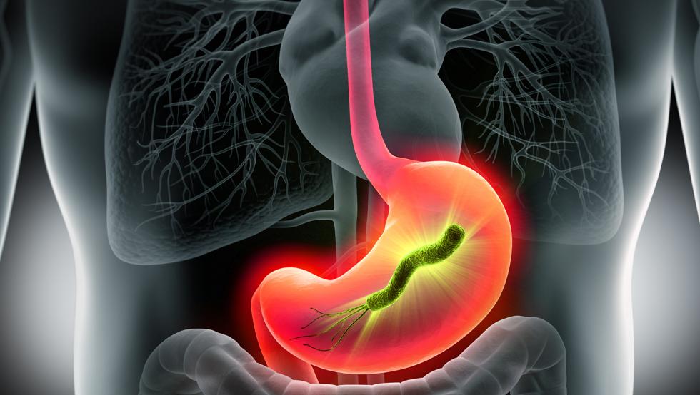 Helicobácter pylori, un tipo de bacteria que infecta el estómago